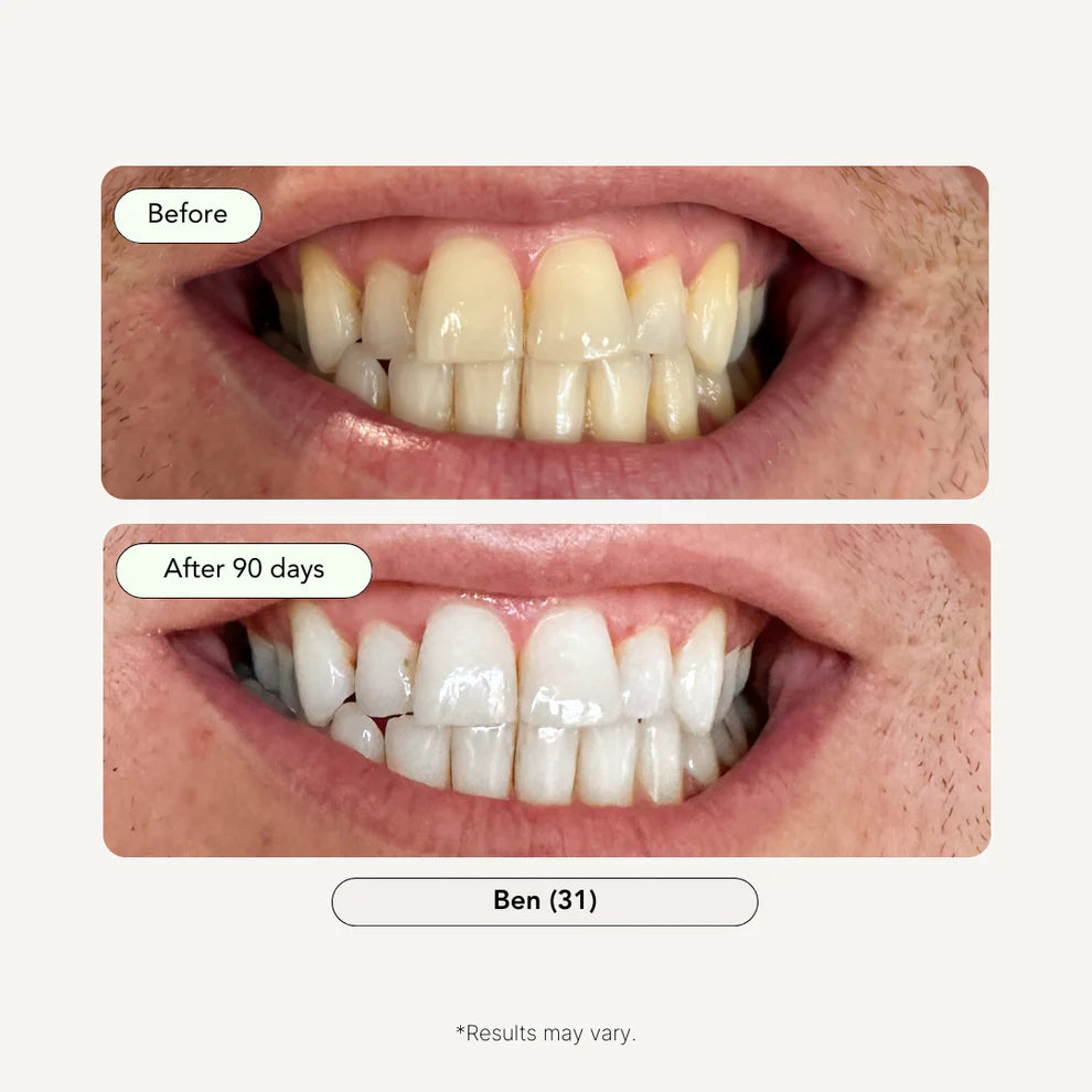 Lovesmiles / 3-Step Coconut Charcoal Oral Care and Whitening Kit