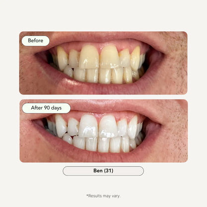 Lovesmiles / 3-Step Coconut Charcoal Oral Care and Whitening Kit